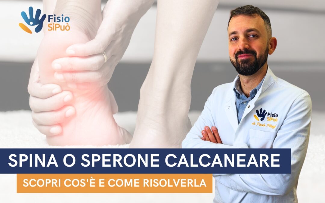 Spina Calcaneare: Che Cos’è e Come Si Cura a Roma