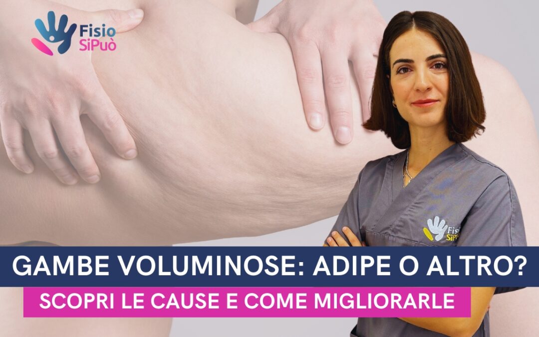 Gambe Voluminose, Adipe o Altro? Scopri le Cause e Come Migliorarle