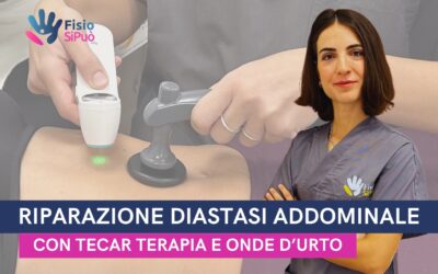 Riparazione della Diastasi Addominale con Tecar Terapia e Onde d’Urto a Roma